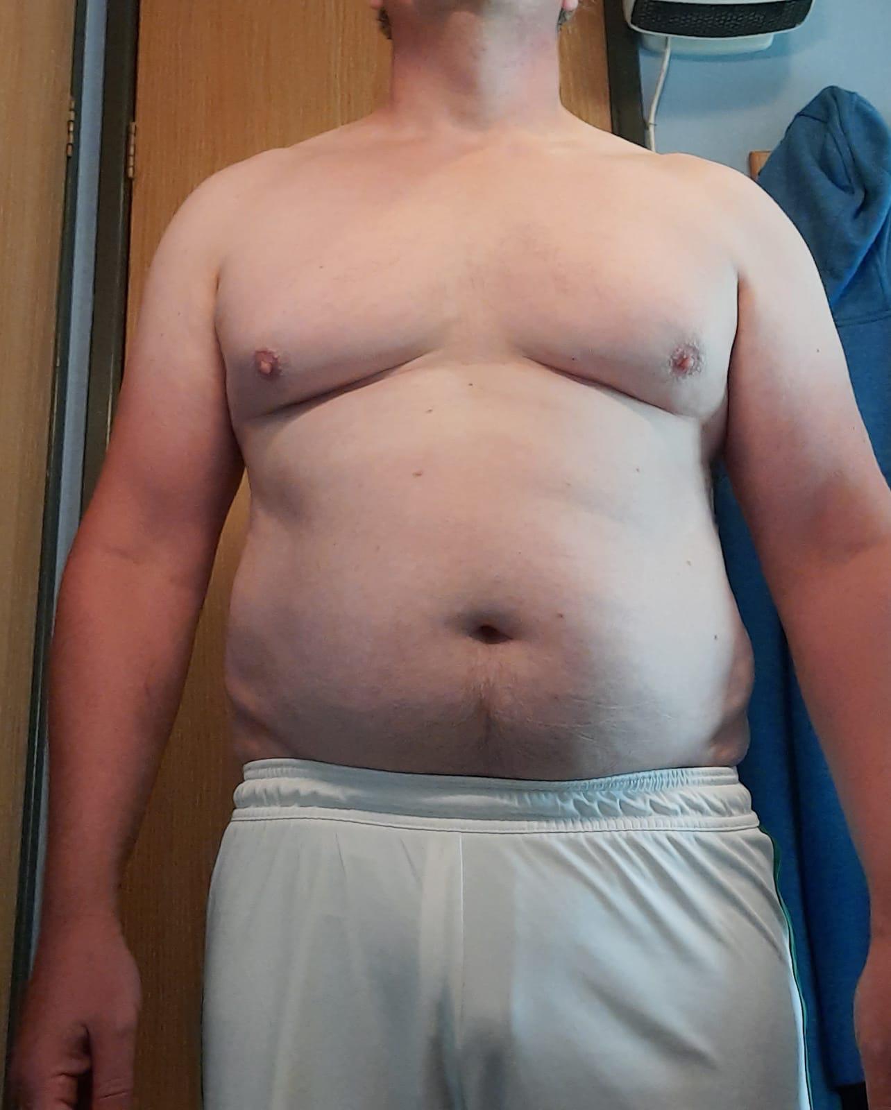 Jamie before photo